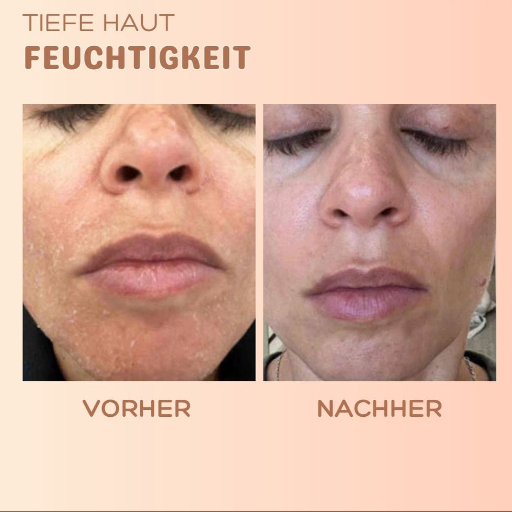 Skin brightness™ Faltenkorrektur Balsam