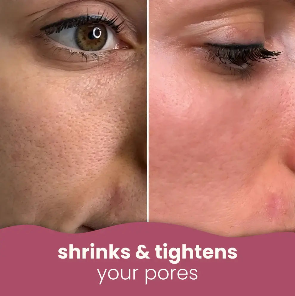 YUVY™ Brightening Turmeric & Kojic Acid Pads
