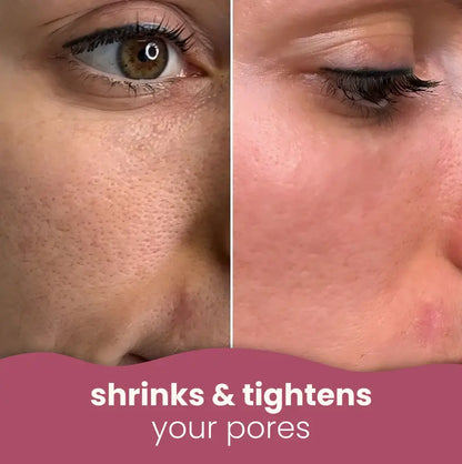 YUVY™ Brightening Turmeric & Kojic Acid Pads
