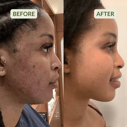 JIYU™ Anti-Aging, Dark Spot & Wrinkle Minimizing Toner Pads