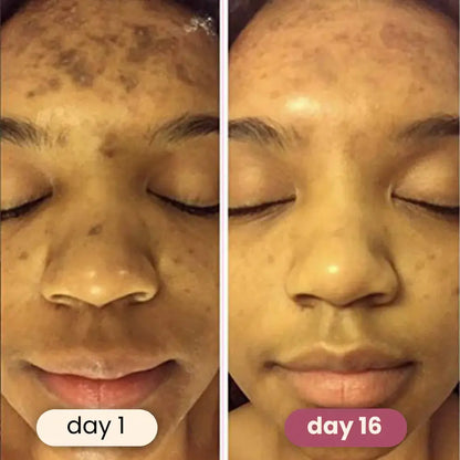 YUVY™ Brightening Turmeric & Kojic Acid Pads