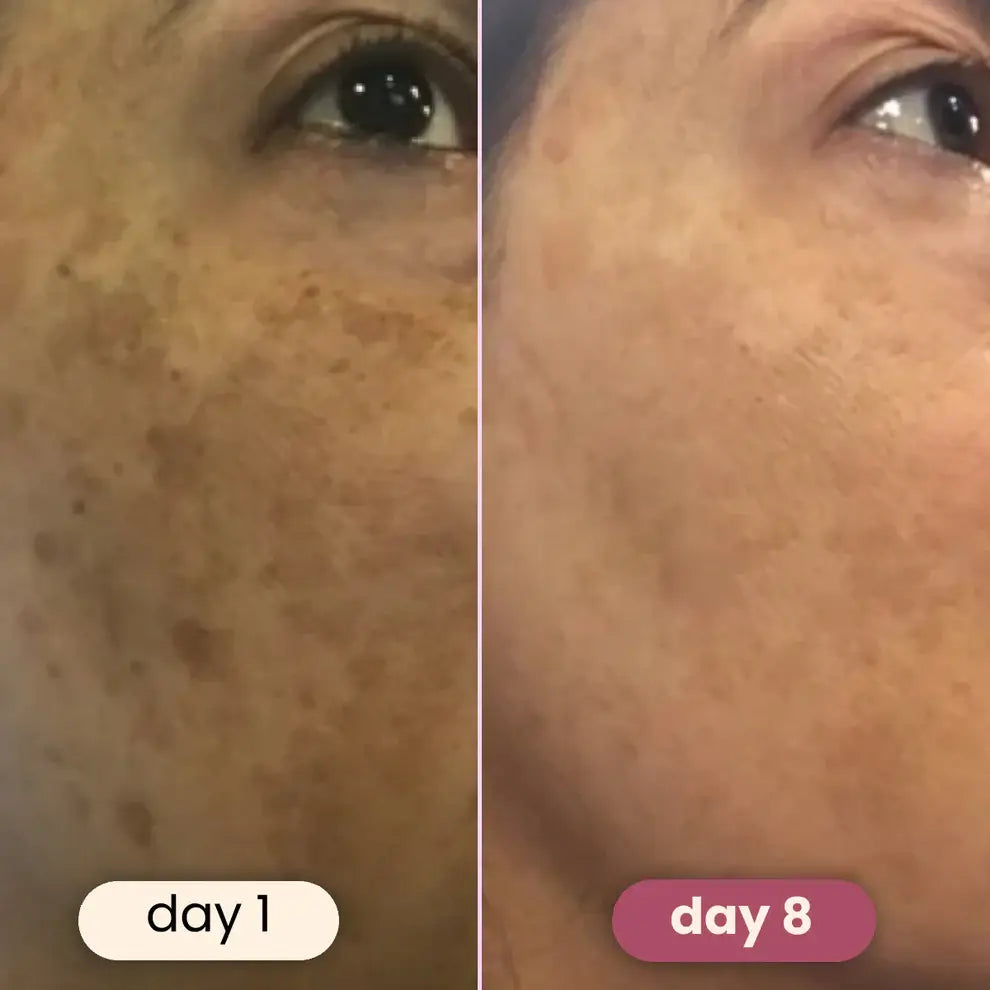YUVY™ Brightening Turmeric & Kojic Acid Pads