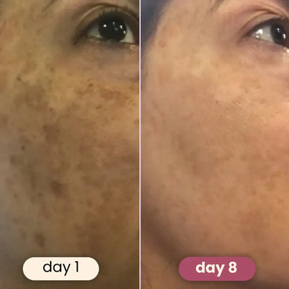 YUVY™ Brightening Turmeric & Kojic Acid Pads