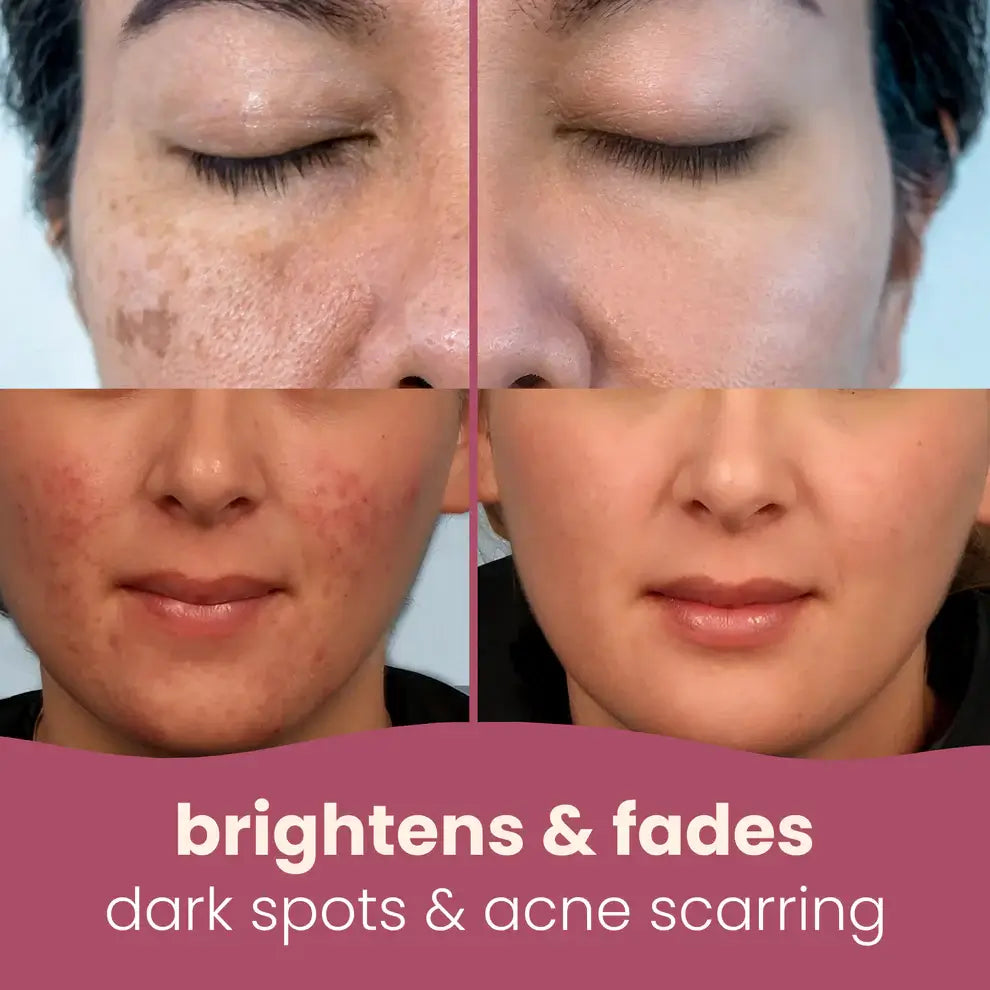 YUVY™ Brightening Turmeric & Kojic Acid Pads